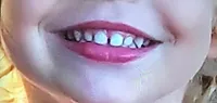 sourire.jpg